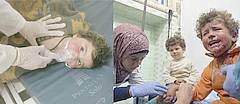 Links ein Kind das Opfer des mutmaßlich syrischen Giftgasanschlags vom 4. April 2017 wurde und rechts ein Kind das Opfer des von Rebellen verübten Busanschlags vom 15. April 2017 wurde.